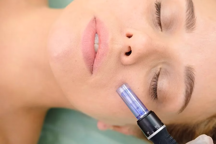 mesotherapy